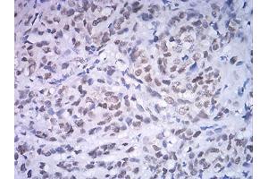 Immunohistochemistry (IHC) image for anti-Activating Transcription Factor 4 (Tax-Responsive Enhancer Element B67) (ATF4) (AA 212-351) antibody (ABIN5542583)