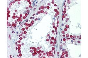 Anti-SAE1 antibody IHC staining of human prostate. (SAE1 Antikörper)