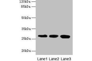 Western blot All lanes: KHDC1 antibody at 5 μg/mL Lane 1: Mouse liver tissue Lane 2: Mouse kidney tissue Lane 3: Mouse gonadal tissue Secondary Goat polyclonal to rabbit IgG at 1/10000 dilution Predicted band size: 28, 19 kDa Observed band size: 28 kDa (KHDC1 Antikörper  (AA 74-237))