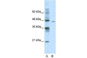 WB Suggested Anti-DDX25  Antibody Titration: 0. (DDX25 Antikörper  (C-Term))