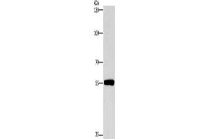 Gel: 8 % SDS-PAGE, Lysate: 40 μg, Lane: Human lymphoma tissue, Primary antibody: ABIN7190422(CYP46A1 Antibody) at dilution 1/200, Secondary antibody: Goat anti rabbit IgG at 1/8000 dilution, Exposure time: 1 minute (CYP46A1 Antikörper)