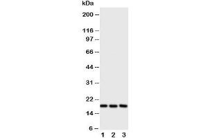 Western blot testing of I-309 antibody and Lane 1:  SCG;  2: COLO320;  3: Jurkat cell lysate. (CCL1 Antikörper  (C-Term))