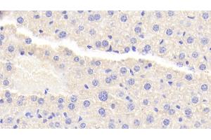 Detection of TNIP2 in Mouse Liver Tissue using Polyclonal Antibody to Tumor Necrosis Factor Alpha Induced Protein 3 Interacting Protein 2 (TNIP2) (TNIP2 Antikörper  (AA 170-413))
