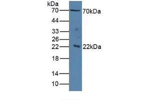 Figure. (IL1RAP Antikörper  (AA 420-558))