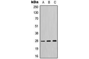 Western blot analysis of 14-3-3 theta/tau expression in HeLa (A), SP2/0 (B), H9C2 (C) whole cell lysates. (14-3-3 theta Antikörper  (C-Term))