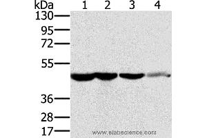 Western blot analysis of HT-29 cell and human normal kidney tissue, Lo2 cell and human normal liver tissue, human fetal brain tissue, using RNH1 Polyclonal Antibody at dilution of 1:400 (RNH1 Antikörper)