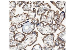 IHC analysis of Hexokinase 1/HK1 using anti-Hexokinase 1/HK1 antibody (ABIN7600259). (Hexokinase 1 Antikörper  (AA 17-323))