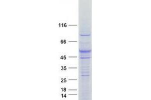 Validation with Western Blot