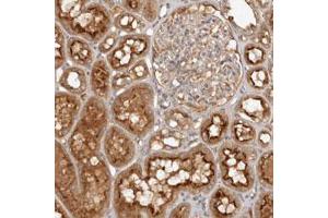 Immunohistochemical staining (Formalin-fixed paraffin-embedded sections) of human kidney with PKIB polyclonal antibody  shows strong cytoplasmic and membranous positivity in cells in tubules.