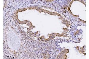 IHC analysis of PMPCB using anti-PMPCB antibody (ABIN7600757). (PMPCB Antikörper  (AA 23-479))