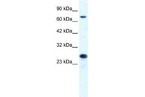 WB Suggested Anti-MCM6 Antibody Titration:  1. (MCM6 Antikörper  (C-Term))