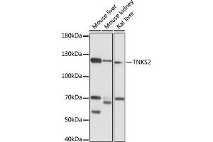 Western blot analysis of extracts of various cell lines, using TNKS2 antibody (ABIN7270726) at 1:1000 dilution. (TNKS2 Antikörper  (AA 780-1050))