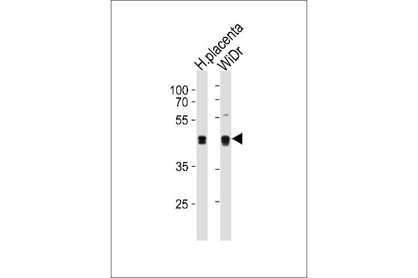 SAP30BP Antikörper  (AA 160-188)