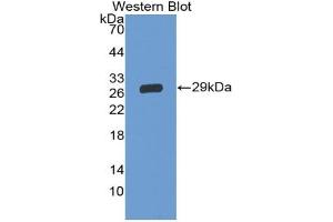Western blot analysis of the recombinant protein. (GP5 Antikörper  (AA 17-242))