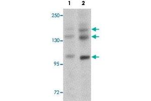 Western blot analysis of rat brain tissue with PRDM16 polyclonal antibody  at (Lane 1) 1 and (Lane 2) 2 ug/mL dilution.
