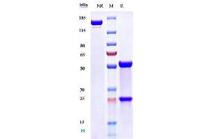 Anti-ANGPT2 Reference Antibody (MEDI3617) on SDS-PAGE under reducing (R) condition.