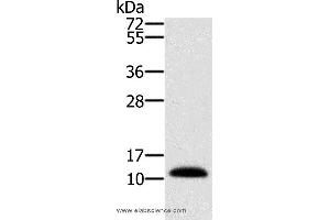 Western blot analysis of Human prostate tissue, using MSMB Polyclonal Antibody at dilution of 1:250