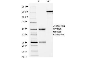SDS-PAGE Analysis Purified HLA-DRB Mouse Monoclonal Antibody (L243).
