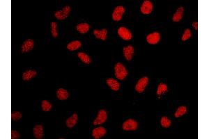 Immunofluorescence (IF) image for anti-Bromodomain Containing 2 (BRD2) (AA 675-725) antibody (ABIN7448918) (BRD2 Antikörper  (AA 675-725))