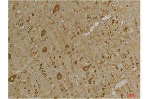 Immunohistochemistry (IHC) analysis of paraffin-embedded Rat Brain Tissue using GABA A Receptor gamma2 Rabbit Polyclonal Antibody diluted at 1:200. (GABRG2 Antikörper)