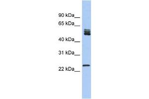 WB Suggested Anti-SFRS7 Antibody Titration: 0. (SFRS7 Antikörper  (N-Term))
