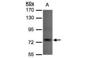 WB Image Sample(30 μg of whole cell lysate) A:293T 7. (TLK1 Antikörper)