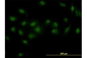 Immunofluorescence of monoclonal antibody to DPF2 on HeLa cell. (DPF2 Antikörper  (AA 56-155))