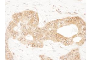 Immunohistochemistry (IHC) image for anti-Acetyl-CoA Acetyltransferase 2 (ACAT2) (AA 150-200) antibody (ABIN7454576)