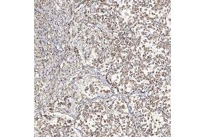 IHC analysis of SFXN5 using anti-SFXN5 antibody (ABIN7601388). (Sideroflexin 5 Antikörper  (AA 34-340))