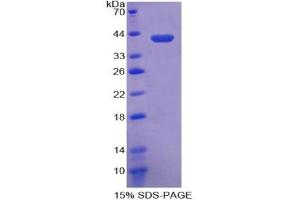 SDS-PAGE (SDS) image for Crystallin, lambda 1 (CRYL1) ELISA Kit (ABIN6574322)