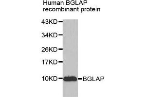 Western blot analysis of extracts of Human BGLAP recombinant protein, using BGLAP antibody. (Osteocalcin Antikörper)