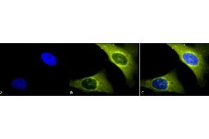 Immunocytochemistry/Immunofluorescence analysis using Rabbit Anti-Rab4 Polyclonal Antibody (ABIN361840 and ABIN361841). (Rab4 Antikörper  (C-Term))