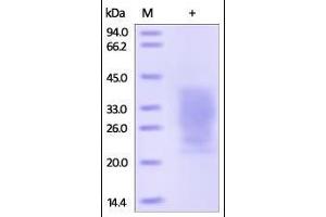 Human PTH1R, His Tag on SDS-PAGE under reducing (R) condition. (PTH1R Protein (AA 27-188) (His tag))