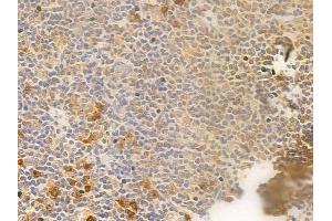 MKK3/MKK6 Antibody at 1/100 staining human normal tonsil tissue by IHC-P.