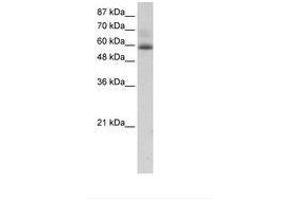 Image no. 1 for anti-Zinc Finger Protein 307 (ZKSCAN4) (AA 272-321) antibody (ABIN202740) (ZKSCAN4 Antikörper  (AA 272-321))