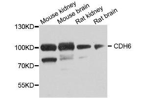 Western blot analysis of extracts of various cell lines, using CDH6 antibody. (CDH6 Antikörper  (AA 1-250))