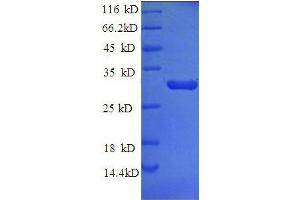 Tissue Factor Pathway Inhibitor (Lipoprotein-Associated Coagulation Inhibitor) (TFPI) (AA 25-300) protein (His tag) (TFPI Protein (AA 25-300) (His tag))