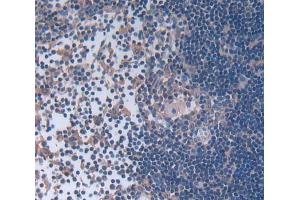 Used in DAB staining on fromalin fixed paraffin- embedded Kidney tissue (Leupaxin Antikörper  (AA 1-208))