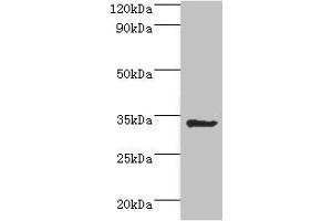 Western blot All lanes: Aminoacyl tRNA synthase complex-interacting multifunctional protein 1 antibody at 2 μg/mL + HepG2 whole cell lysate Secondary Goat polyclonal to rabbit IgG at 1/10000 dilution Predicted band size: 35, 38 kDa Observed band size: 35 kDa (AIMP1 Antikörper  (AA 25-180))