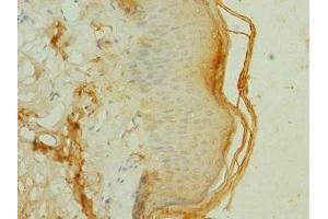 Immunohistochemistry of paraffin-embedded human skin tissue using ABIN7152849 at dilution of 1:100 (FRS3 Antikörper  (AA 101-400))