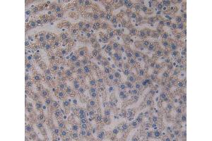 IHC-P analysis of liver tissue, with DAB staining. (Paxillin Antikörper  (AA 327-568))