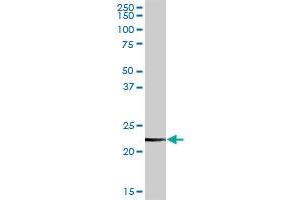 CLTB MaxPab rabbit polyclonal antibody. (CLTB Antikörper  (AA 1-211))