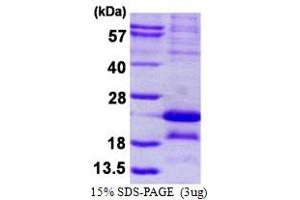 Image no. 1 for Melanoma Antigen Family A, 5 (MAGEA5) (AA 1-124) protein (His tag) (ABIN1098595)