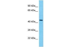 Western Blotting (WB) image for anti-KIAA0895-Like (KIAA0895L) (N-Term) antibody (ABIN2791611) (KIAA0895L Antikörper  (N-Term))