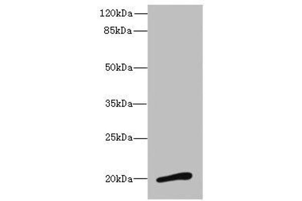 Neuromedin U Antikörper  (AA 35-174)