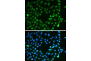 Immunofluorescence analysis of A549 cell using SALL4 antibody. (SALL4 Antikörper)