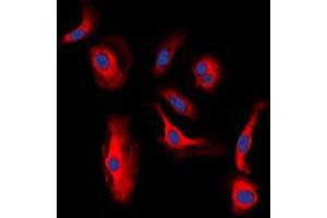 Immunofluorescent analysis of HER3 (pY1328) staining in MCF7 cells.