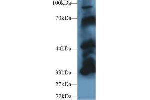 Western Blot; Sample: Mouse Cerebrum lysate; Primary Ab: 1µg/ml Rabbit Anti-Mouse PTPN5 Antibody Second Ab: 0. (PTPN5 Antikörper  (AA 270-533))