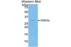 Western Blotting (WB) image for anti-Phosphoinositide-3-Kinase, Class 2, alpha Polypeptide (PIK3C2A) (AA 172-403) antibody (ABIN1860217) (PIK3C2A Antikörper  (AA 172-403))