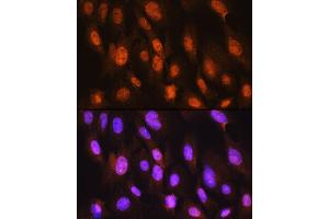Immunofluorescence analysis of C6 cells using DDIT3/CHOP Rabbit pAb (ABIN6131563, ABIN6139461, ABIN6139464 and ABIN6222163) at dilution of 1:100. (DDIT3 Antikörper)